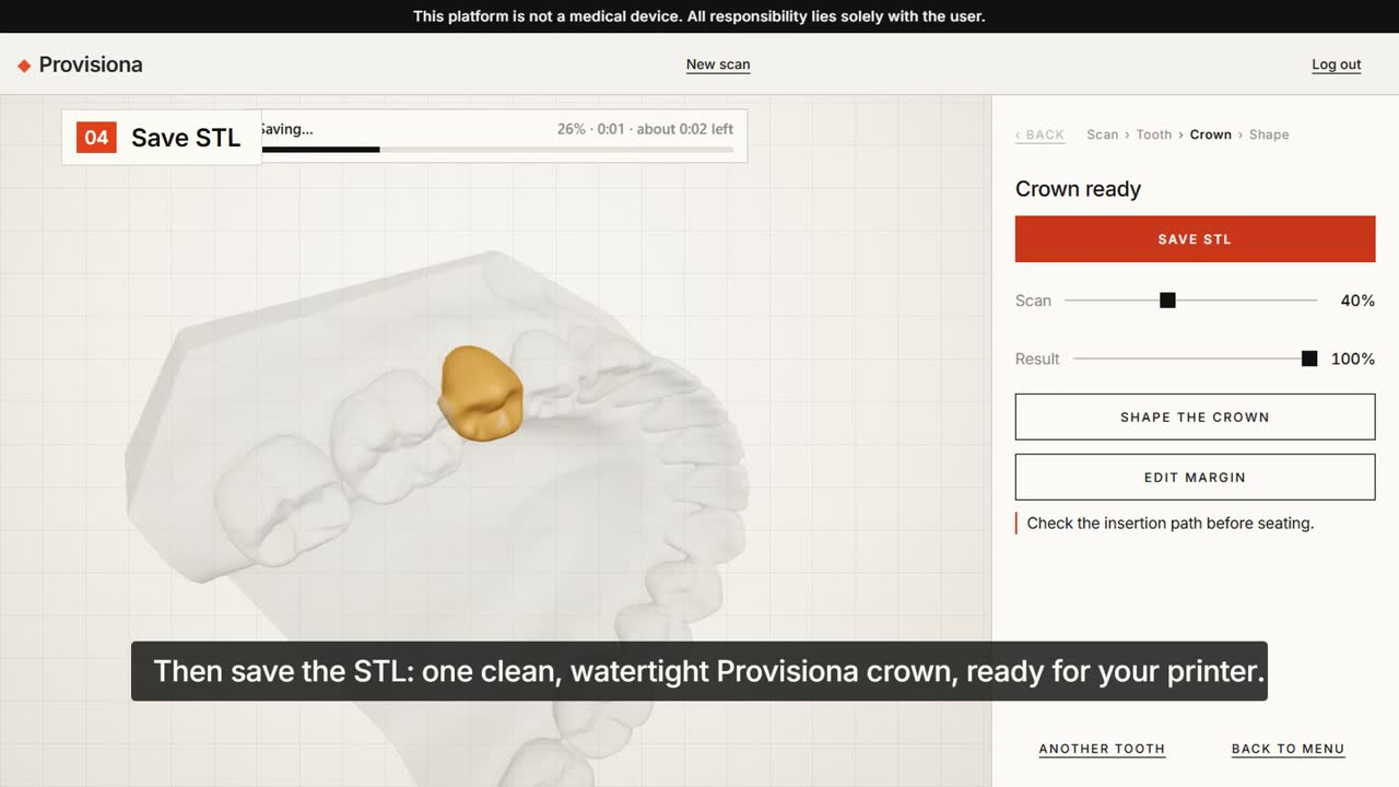 Shape the crown, then save the STL